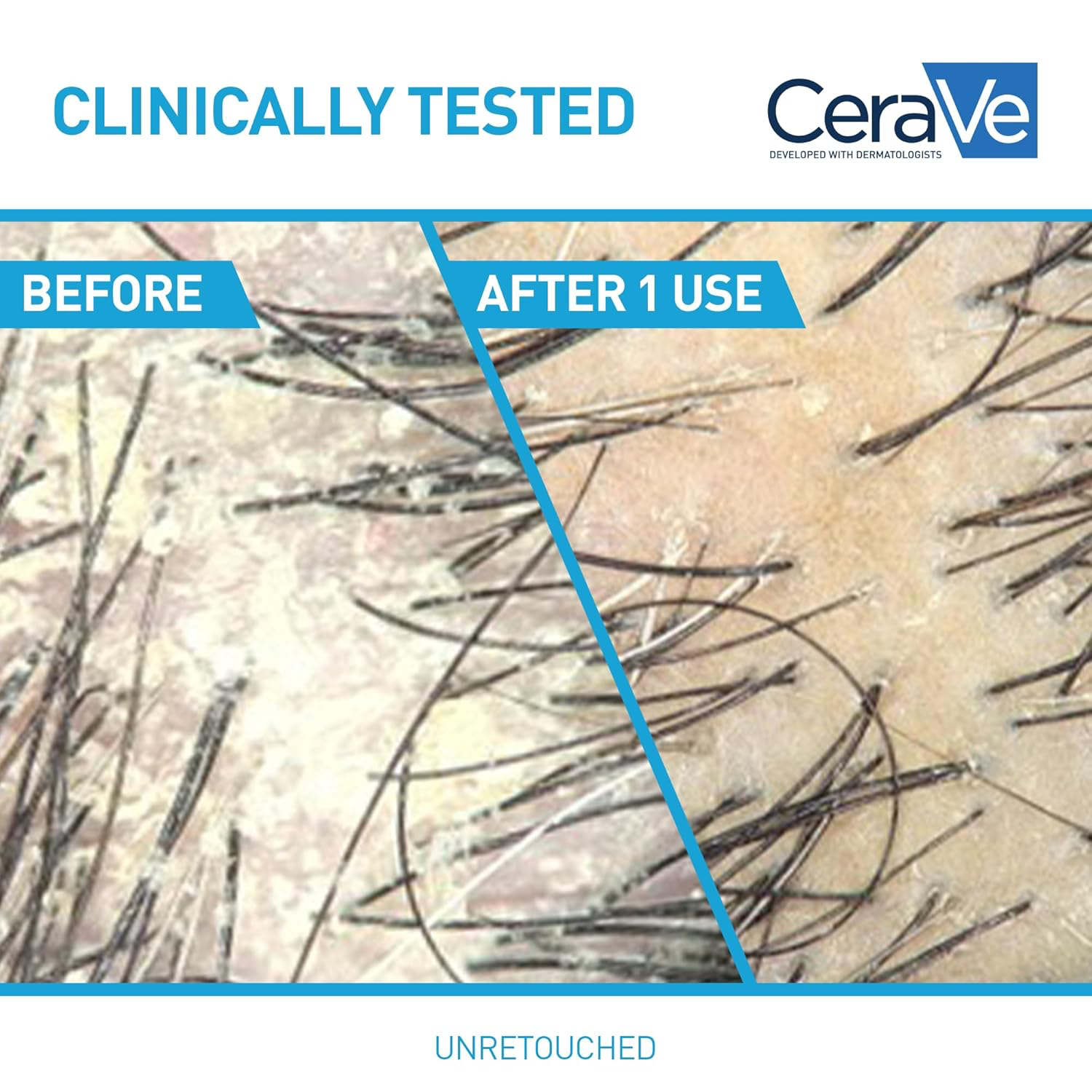 CeraVe Hydrating Anti-Dandruff Conditioner view 3