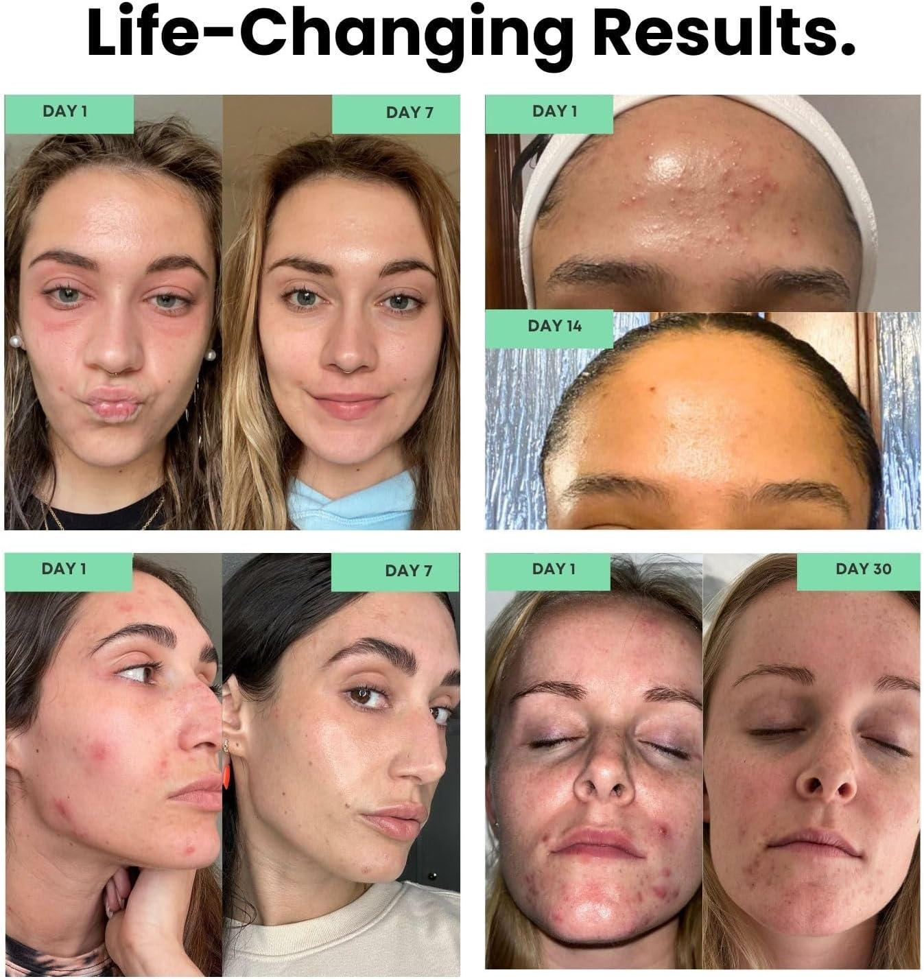 Filterbaby Skincare Filter view 2